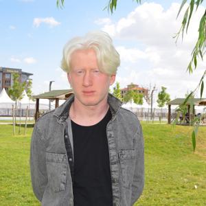 Albino hastası Emirhan:  İnsanlar farklı yaklaşımlar sergileyebiliyor